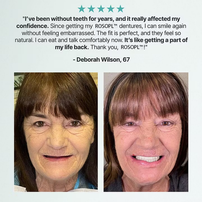 LUMIVO™ Custom-Fit Dentures ⏰ ENDS TODAY • 70% OFF | Smile with Confidence